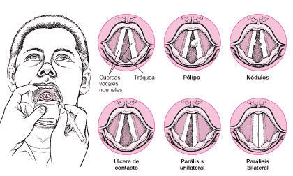 higiene vocal